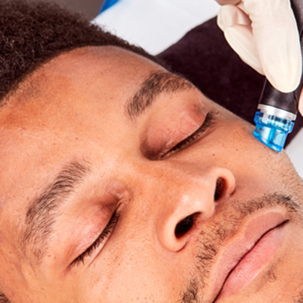 Hydrafacial London is the Best for Dull Skin